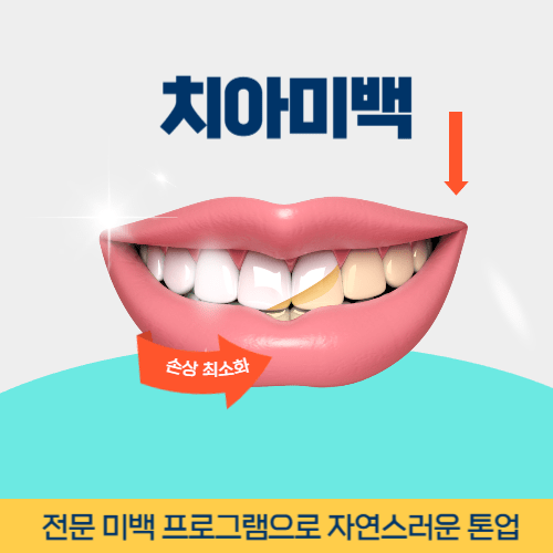 여주치과 여주시 치과 치아미백